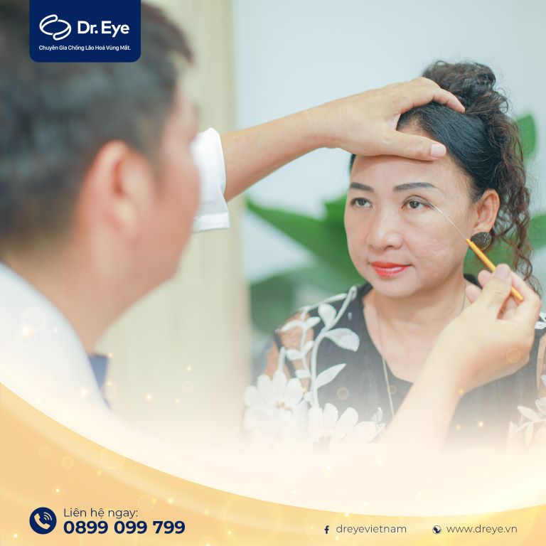 cắt mí sau bao lâu thì mí mắt sẽ đẹp