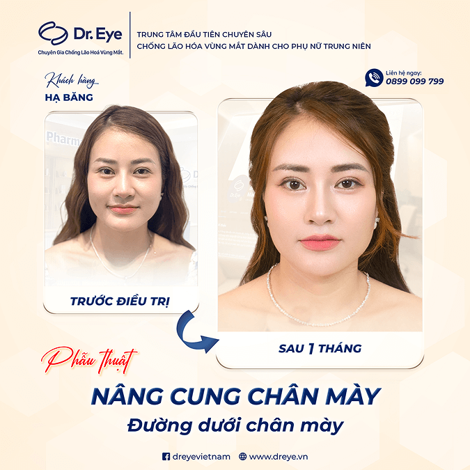 Mí mắt đều đẹp