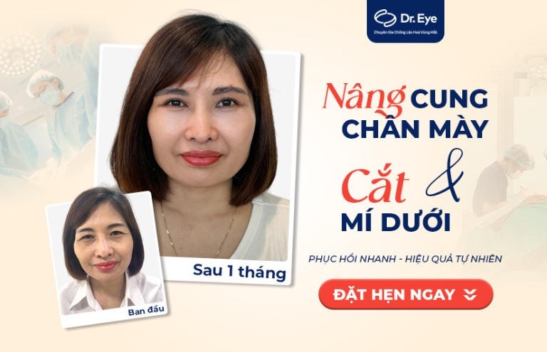 cách chăm sóc sau khi nâng cung mày