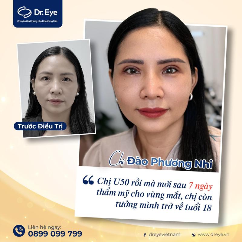 Kết quả sau điều trị của khách hầng Phương Nhi