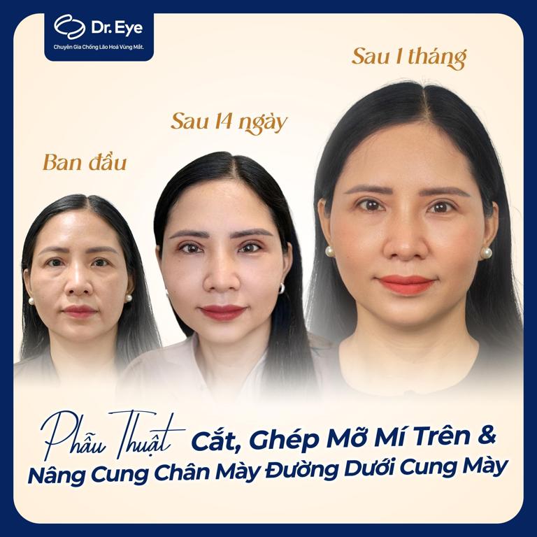 Sự thay đổi của khách hàng Phương Nhi