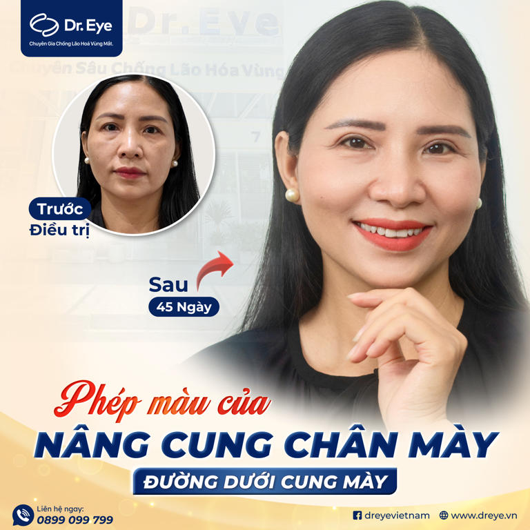 treo cung lông mày