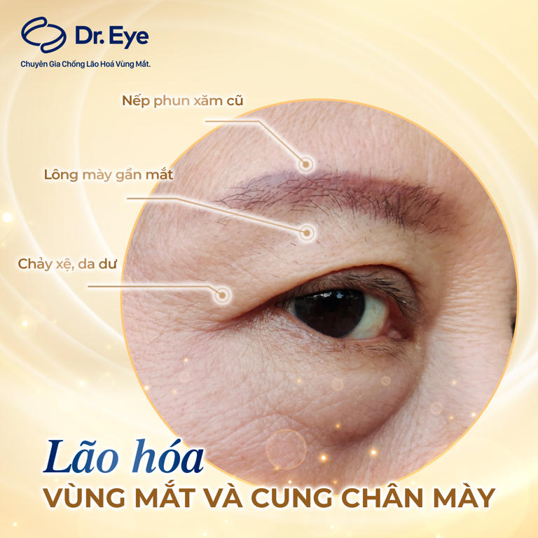 lão hóa vùng mắt và cung chân mày