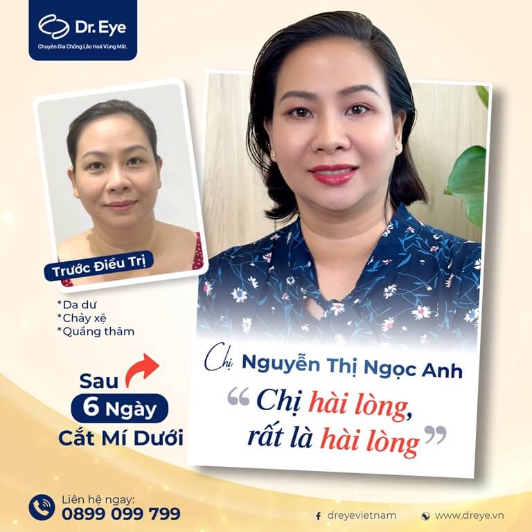 cách dùng mặt nạ mắt