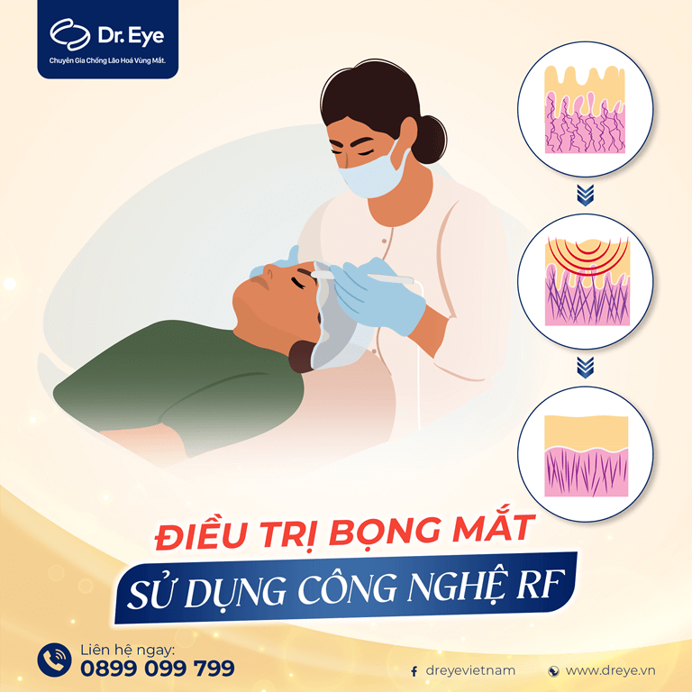 massage bọng mắt