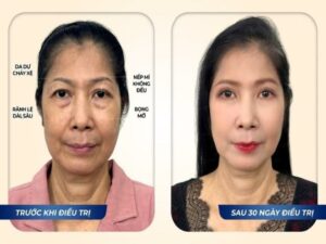 Trust us to rejuvenate your eye area at the 9th place