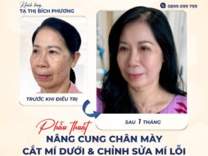 Love yourself to stay youthful and beautiful every day