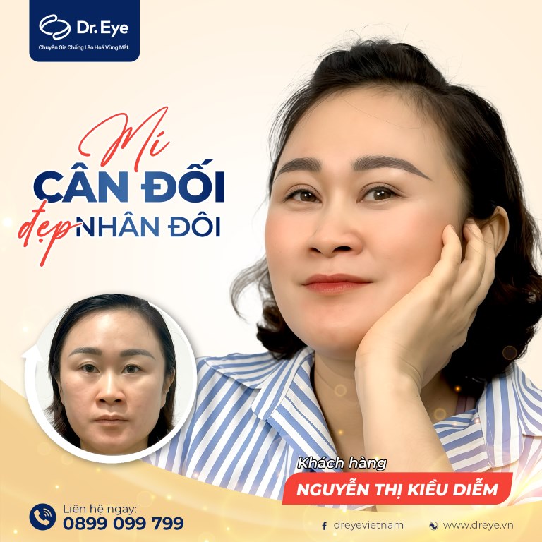 lợi ích khi ăn rau dền sau khi cắt mí 