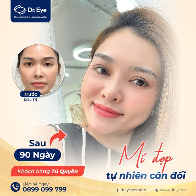 Khách hàng sau khi trãi nghiệm dịch vụ tại Dr. Eye