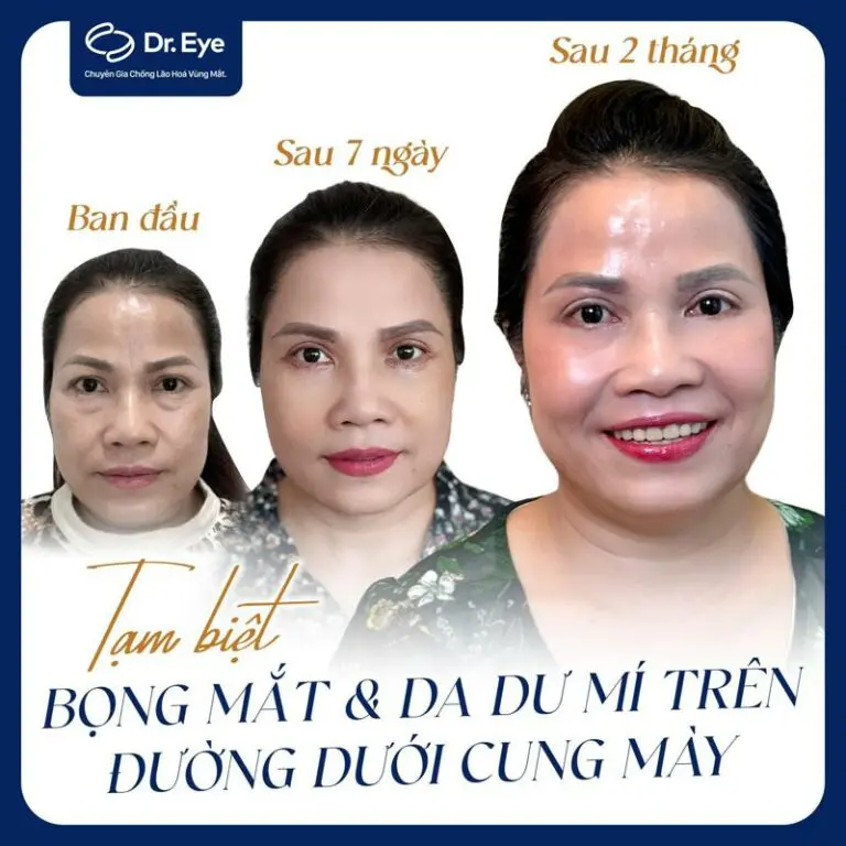 tướng lông mày giao nhau