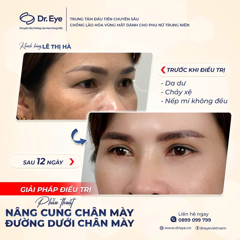 ý nghĩa chân mày xoáy ở đuôi