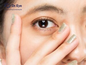 What is Indian eyelid surgery? Is it suitable for Vietnamese people?