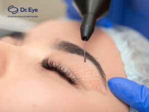 What is double eyelid surgery and 9 things to know to have natural eyelid folds