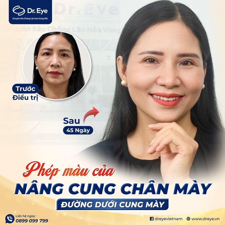 phép màu của nâng cung chân mày