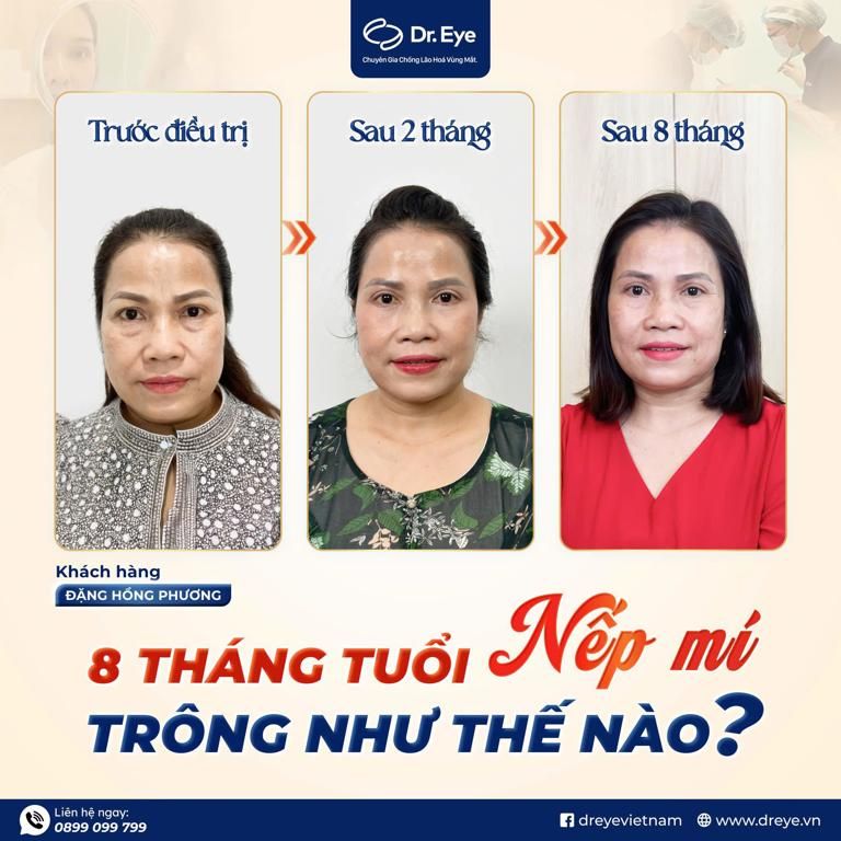 kẻ eyeliner cho mắt sụp mí dễ nhất
