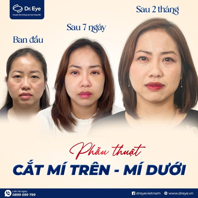 kẻ eyeliner mắt sụp mí