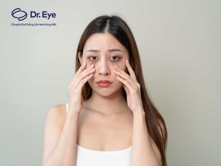 Vì sao ngủ đủ giấc nhưng mắt vẫn thâm? 6 lý do không ngờ