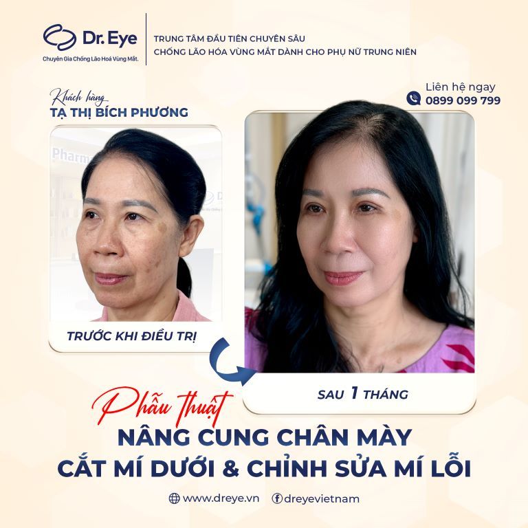 dấu hiệu xăm chân mày bị lỗi