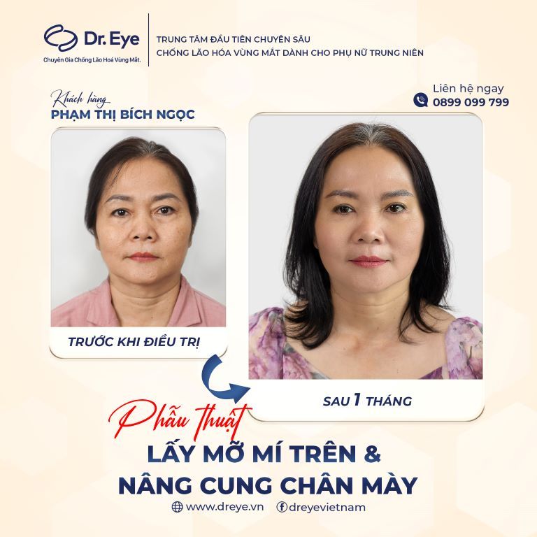 xăm chân mày lỗi tại sao