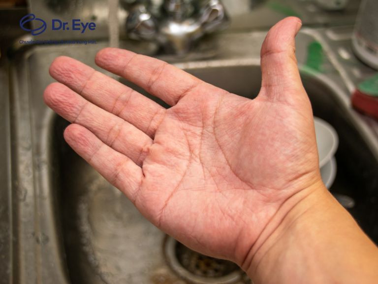 Lý giải nguyên nhân bàn tay nhăn nheo & cách chăm sóc đúng