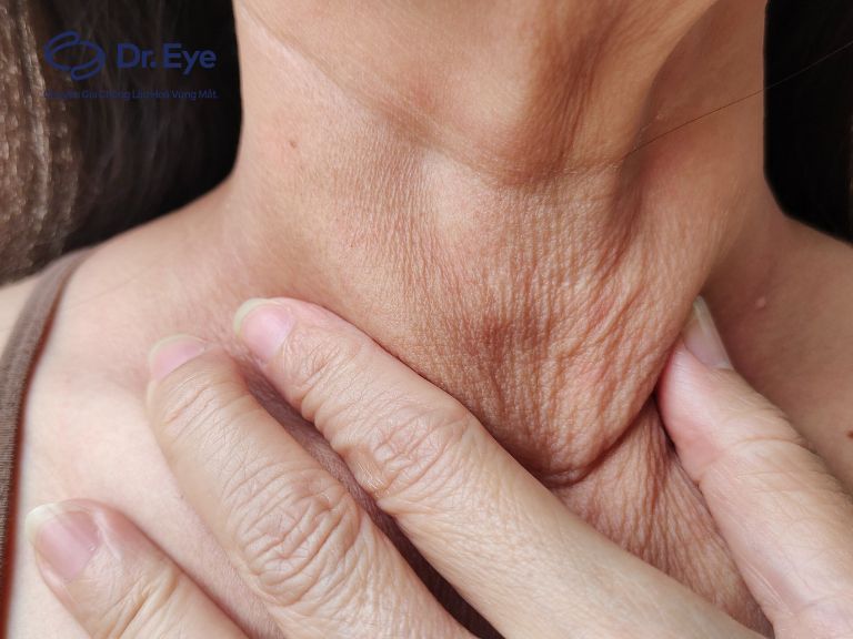 5 cách chăm sóc da cổ trắng sáng, ngăn ngừa lão hóa tối đa