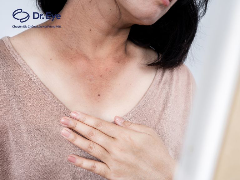 9 nguyên nhân da cổ bị sạm đen và cách khắc phục hiệu quả
