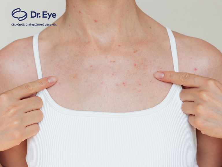 da cổ bị sần do mụn sưng viêm