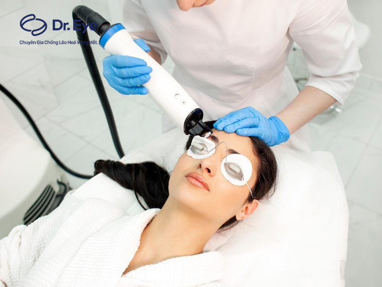 Laser căng da mặt không phẫu thuật