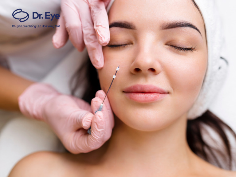 Căng chỉ collagen có an toàn không