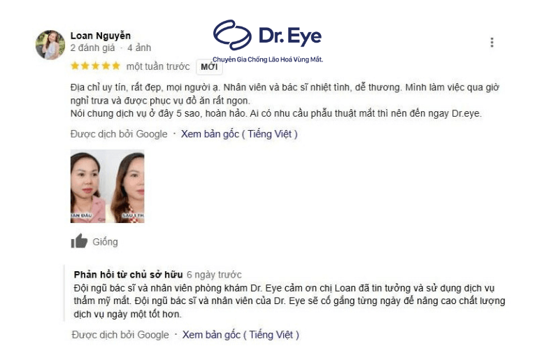 Cắt mí đẹp, chất lượng tại Dr.Eye