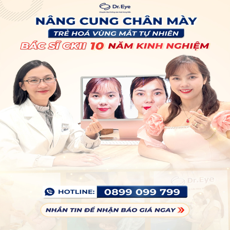 Nâng cung chân mày tại Dr. Eye