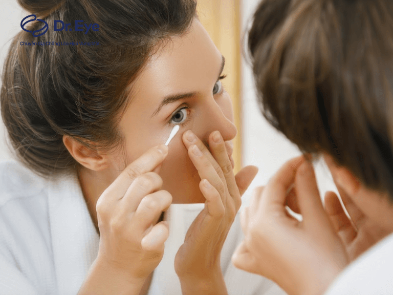 Cách chăm sóc mắt sau cắt mí đúng chuẩn, mí vào nếp đẹp
