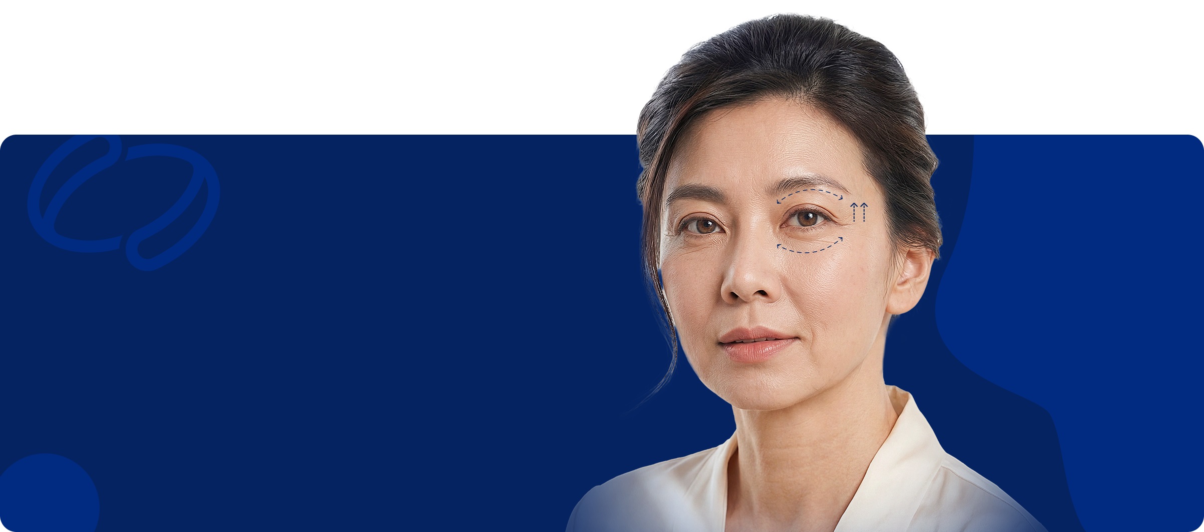 Lower eyelid rejuvenation