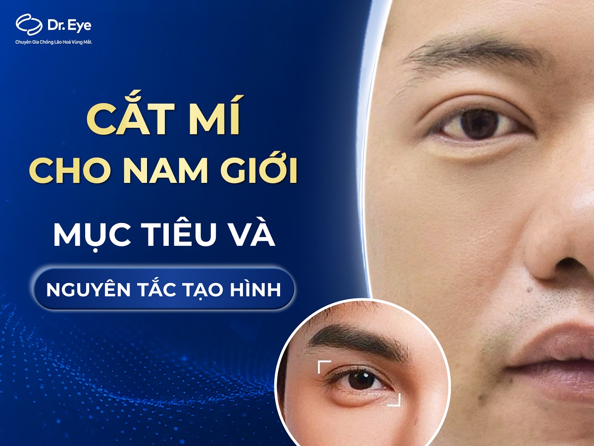Cắt mí cho nam giới: Mục tiêu và nguyên tắc tạo hình