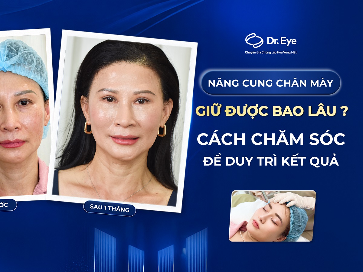 Nâng cung chân mày giữ được bao lâu? Cách chăm sóc để duy trì kết quả