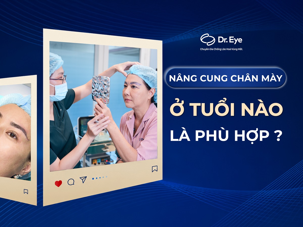 Nâng cung chân mày ở tuổi nào phù hợp? Bác sĩ giải đáp