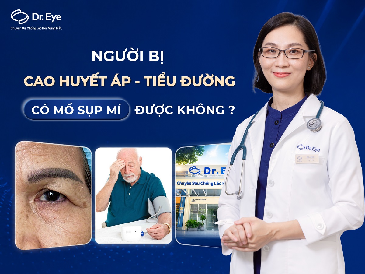 Người cao huyết áp, tiểu đường có mổ sụp mí được không?
