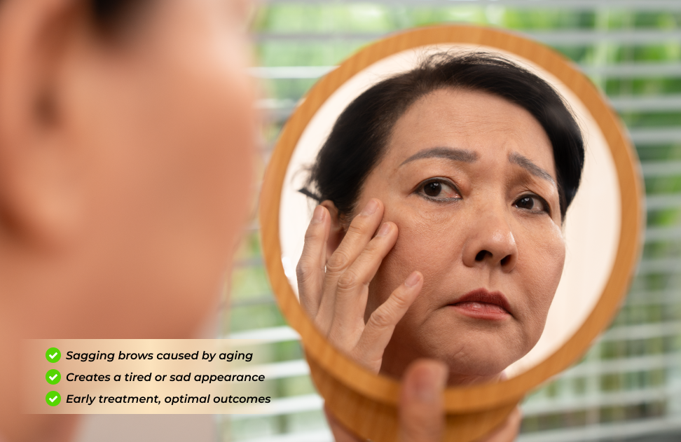 Sagging Brow Lift