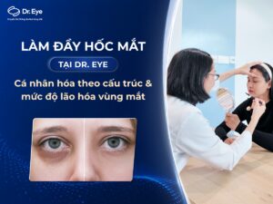 Làm đầy hốc mắt tại Dr. Eye: Cá nhân hóa theo cấu trúc và mức độ lão hóa vùng mắt