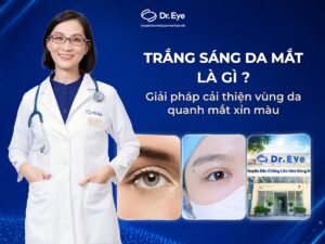 Trắng da vùng mắt là gì? Giải pháp cải thiện da xỉn màu